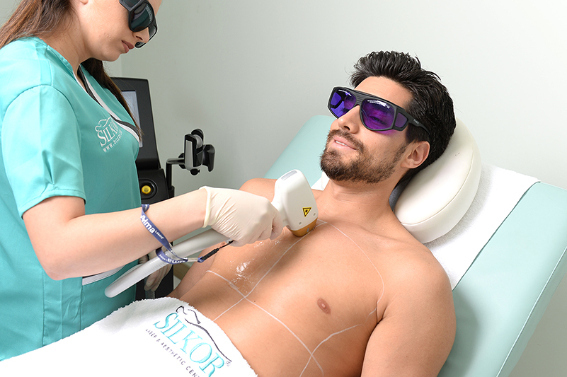 Laser hair removal chest area