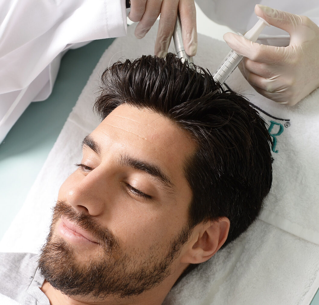 Mesotherpay hair loss treatment for men at Silkor.