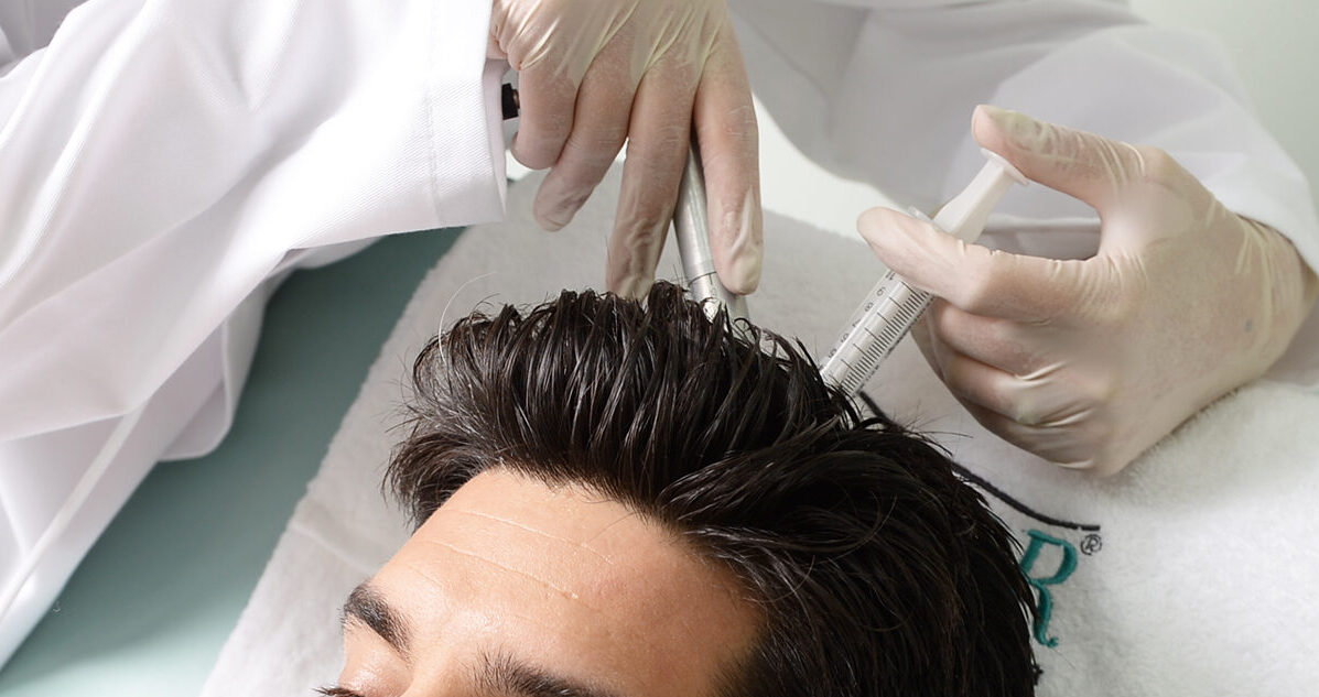 Mesotherpay hair loss treatment for men at Silkor.
