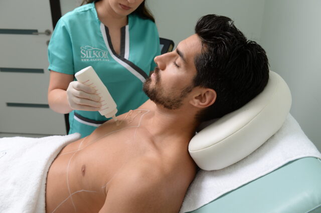 laser hair removal