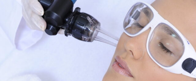 Fractional CO2 Laser
