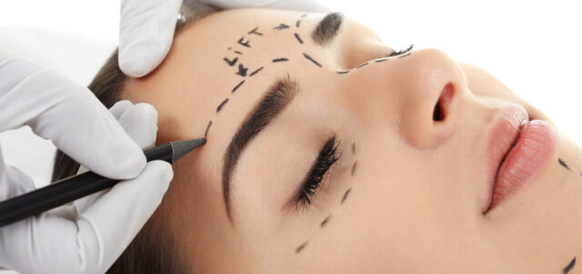Brow Lift
