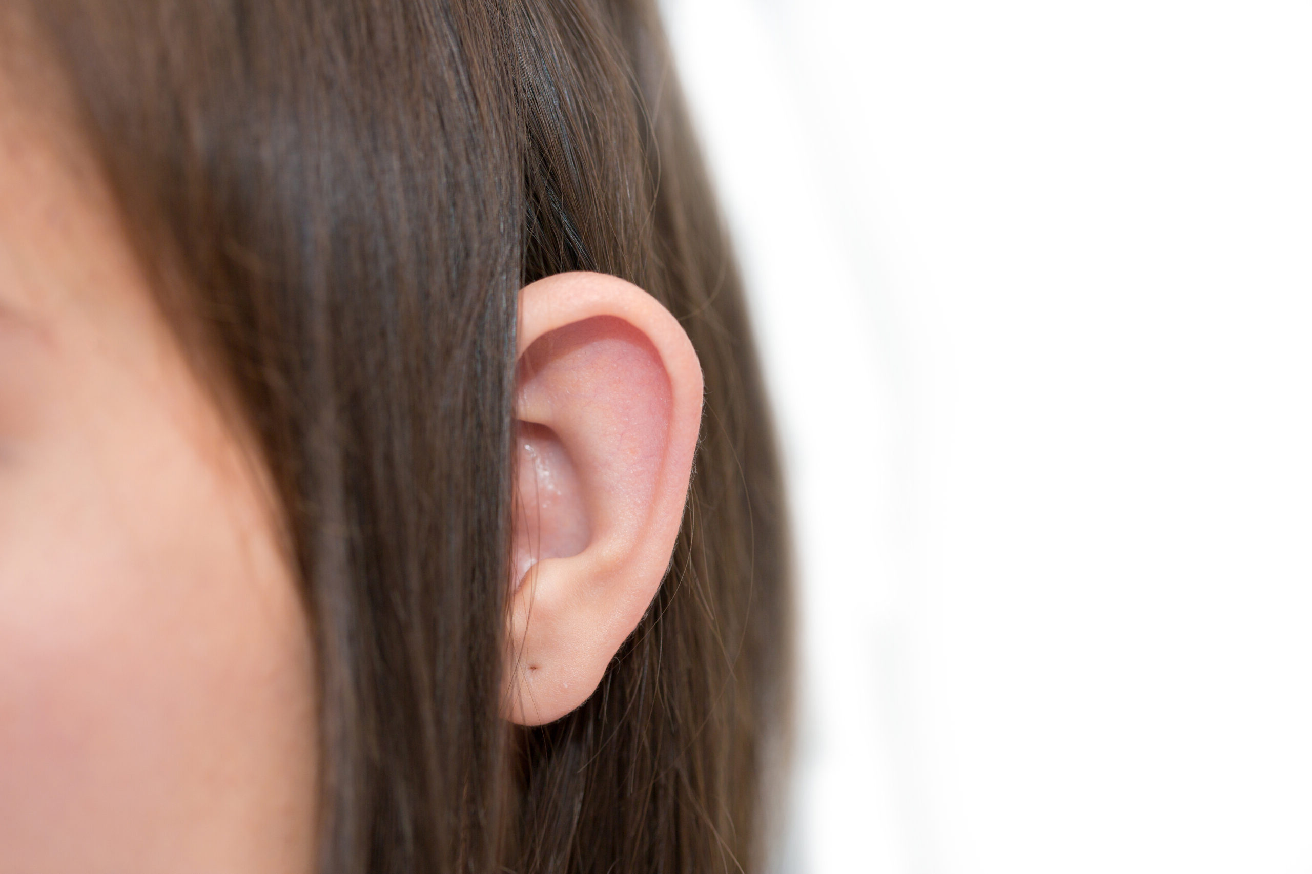 جراحة تجميل الأذن- أوتوبلاستي