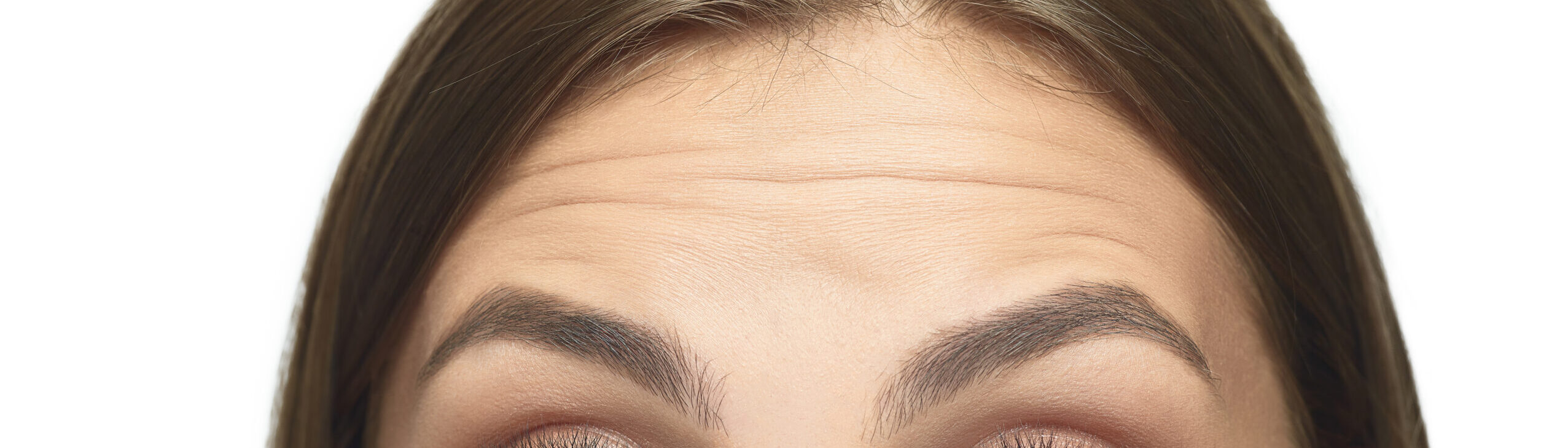  Forehead Lines