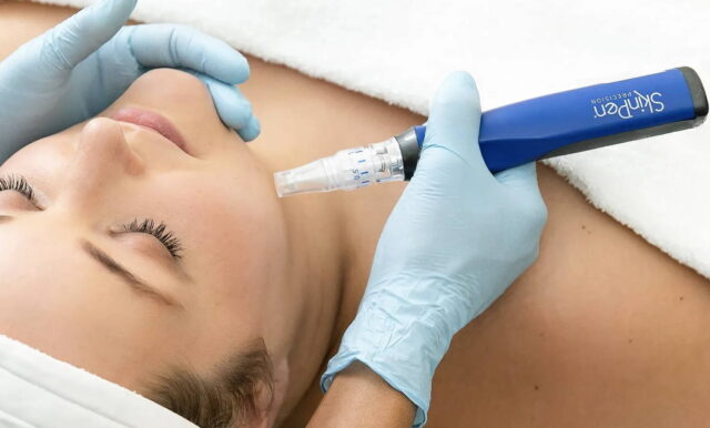 SkinPen Microneedling Treatment