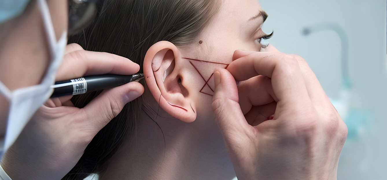 جراحة شحمة الأذن وما بعدها: التوقيت، الشفاء، والاختيار الصحيح